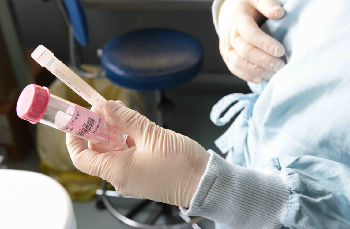 Covid-19, dépistage