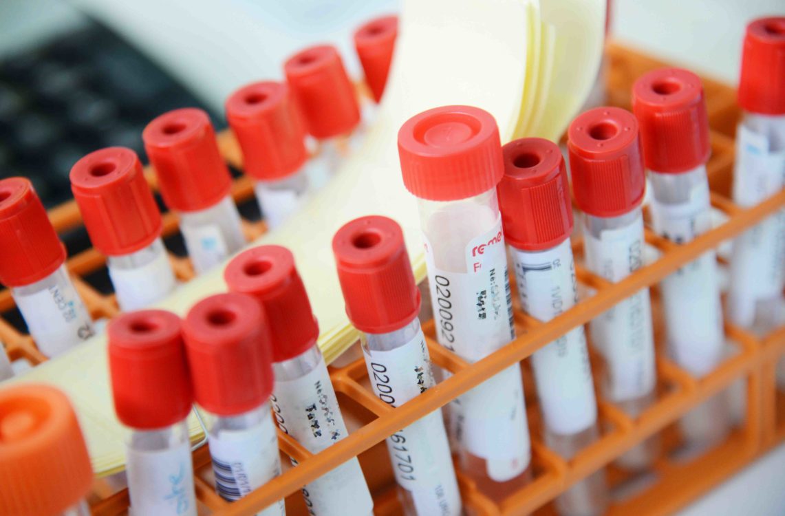 Covid-19, dépistage