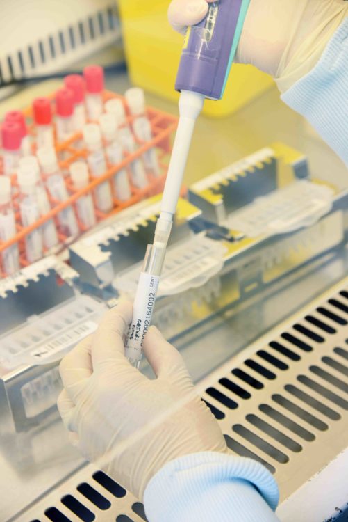 Covid-19, dépistage