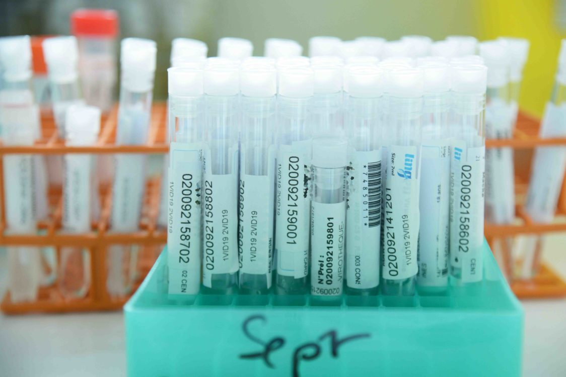 Covid-19, dépistage