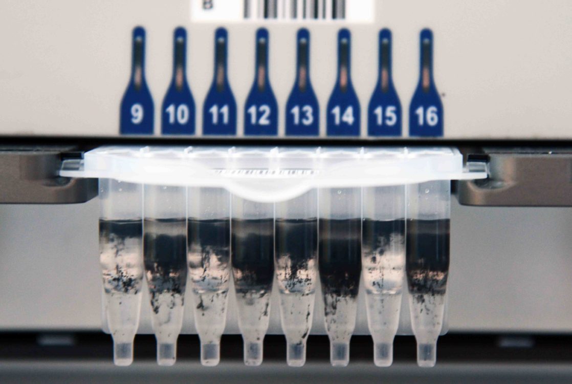 Covid-19, dépistage