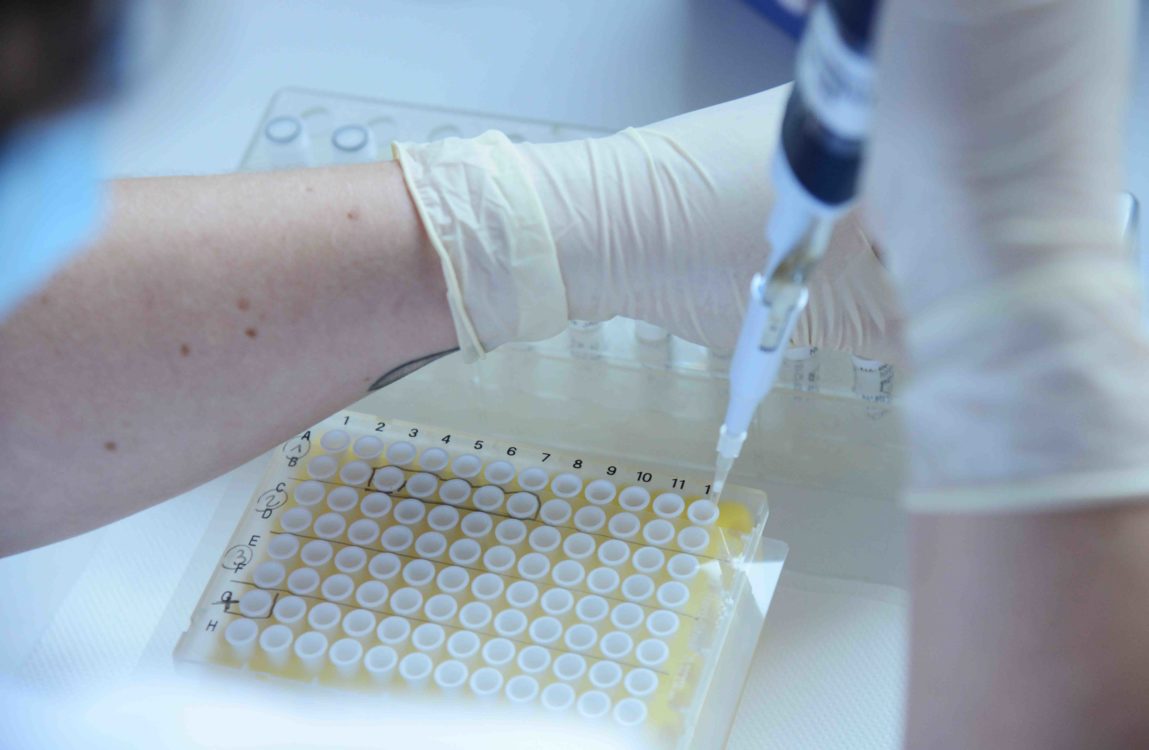 Covid-19, dépistage